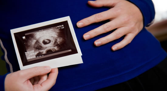 ¿En qué labores es permitido realizar prueba de embarazo para contratar?
